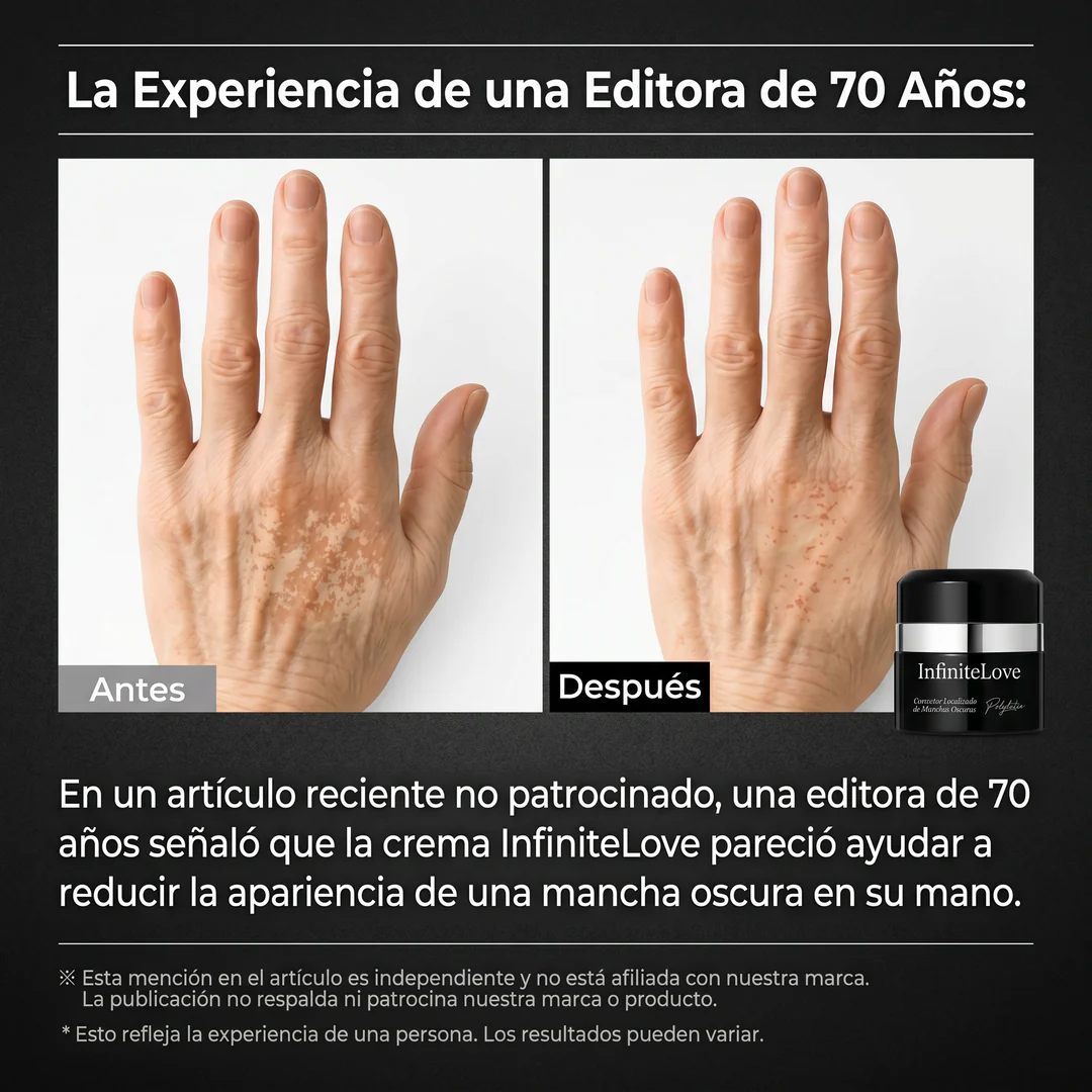 Crema Despigmentante Intensiva – Reduce Manchas y Unifica el Tono - Image 3