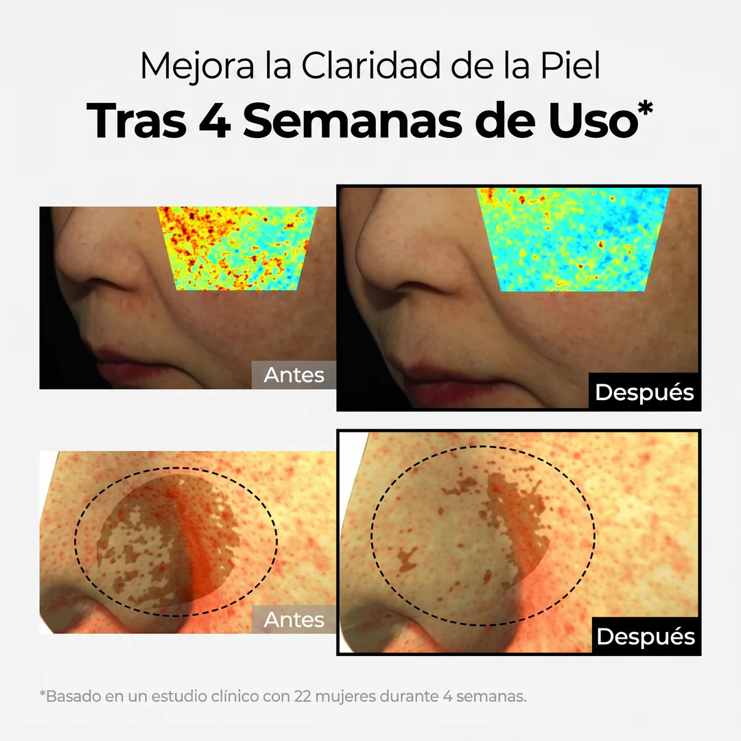 Crema Despigmentante Intensiva – Reduce Manchas y Unifica el Tono - Image 4