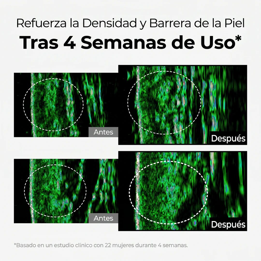 Crema Despigmentante Intensiva – Reduce Manchas y Unifica el Tono - Image 5