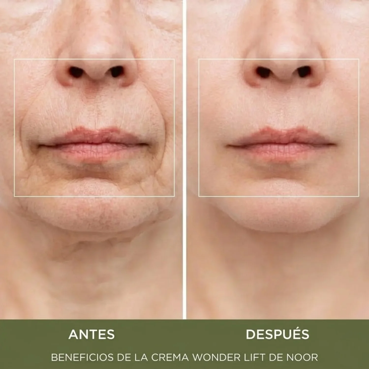 Crema Antiarrugas 'Efecto Botox' Wonder Lift con Péptidos Syn-Ake™ (Resultados en 4 Días) - Image 4