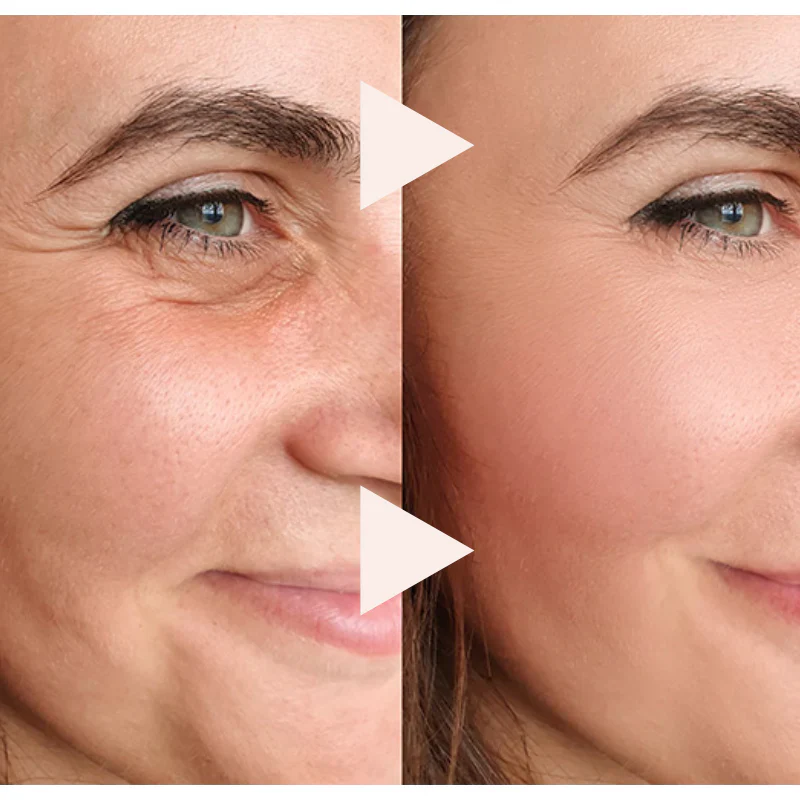 El Antiedad Exprés - Efecto Lifting Instantáneo - Image 3