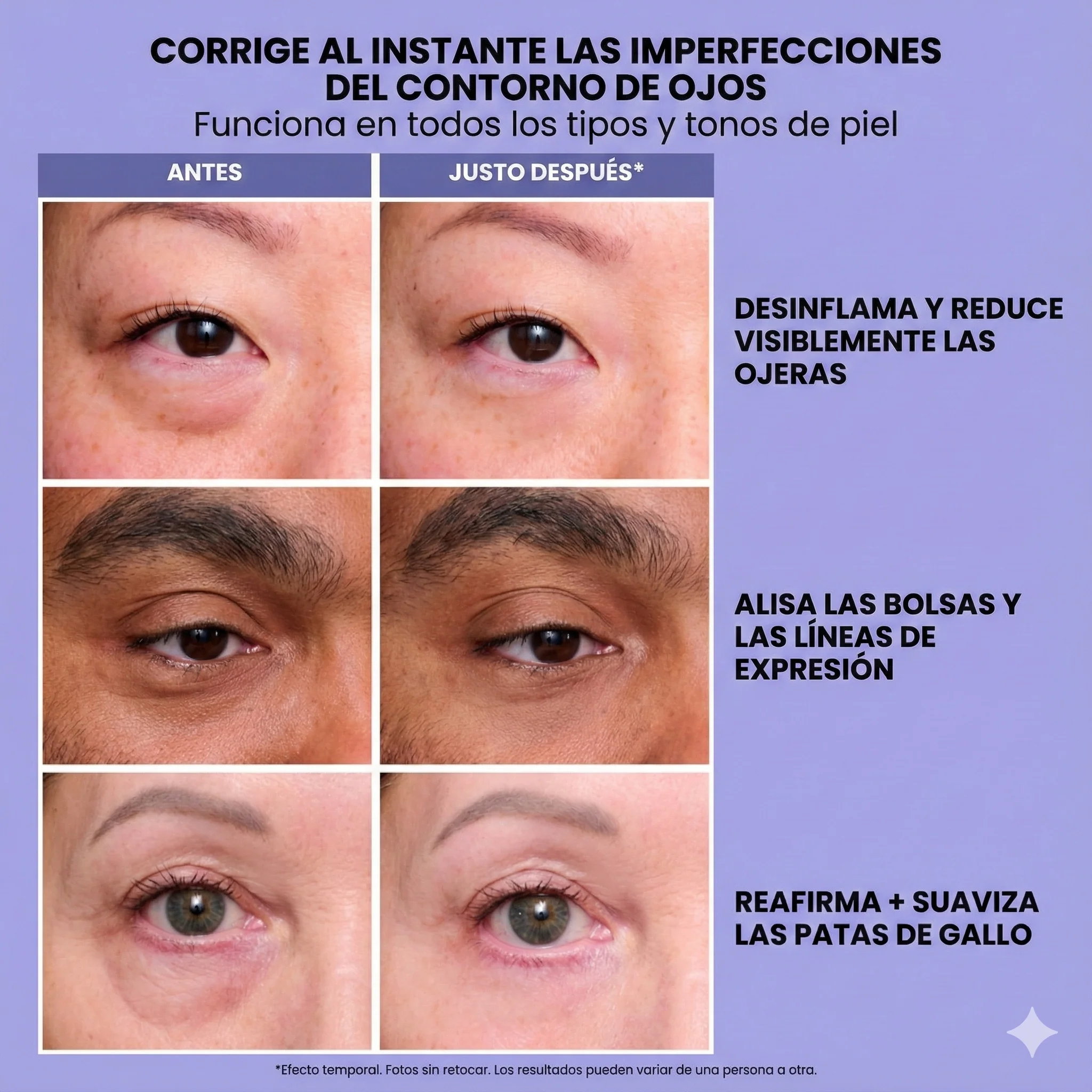InfiniteLift | Gel tensor rejuvenecedor para los ojos - Image 5