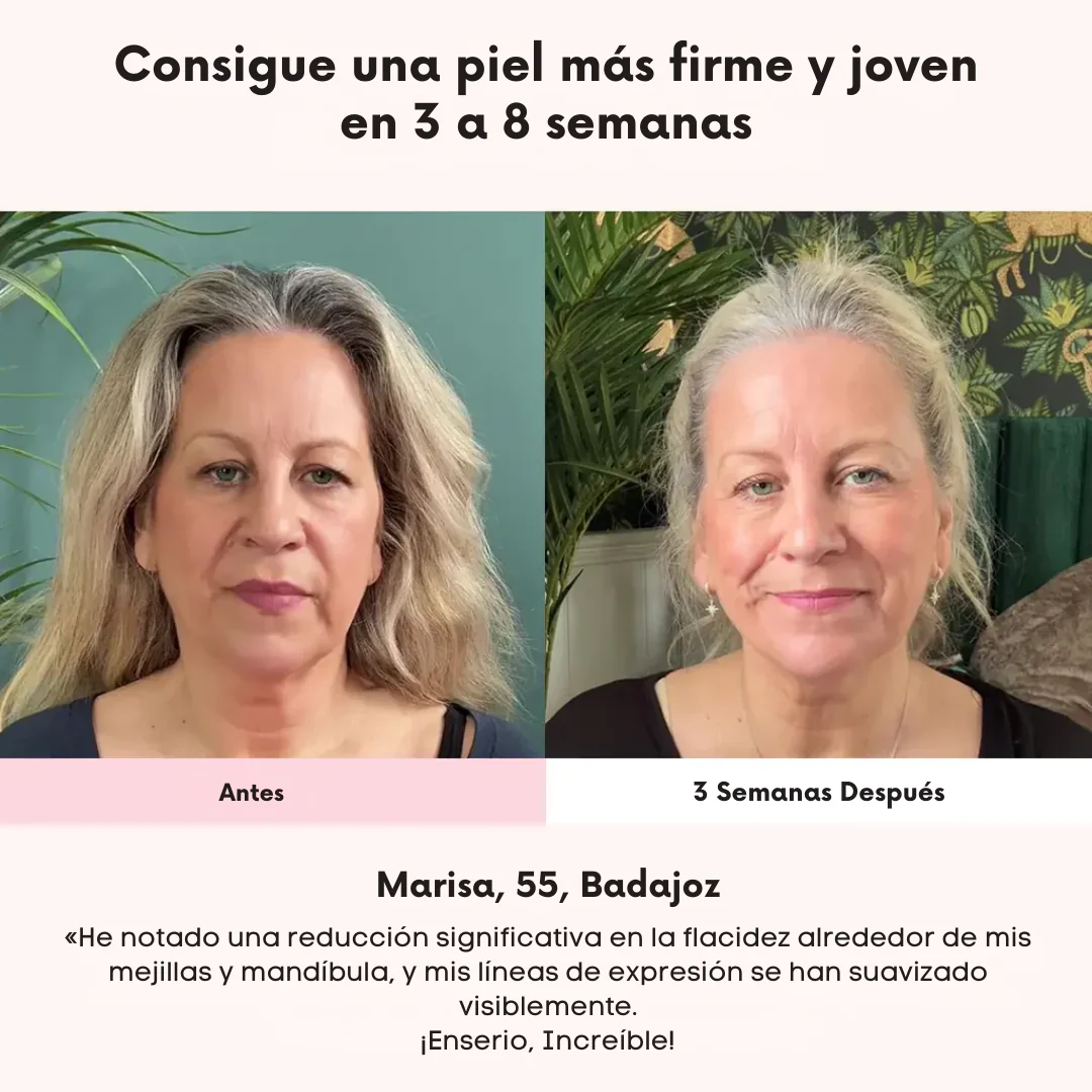 Máscara Facial Anti-Edad de 7 Colores LED y Microcorriente (EMS) para Lifting de Papada y Reafirmar Mejillas - Image 7