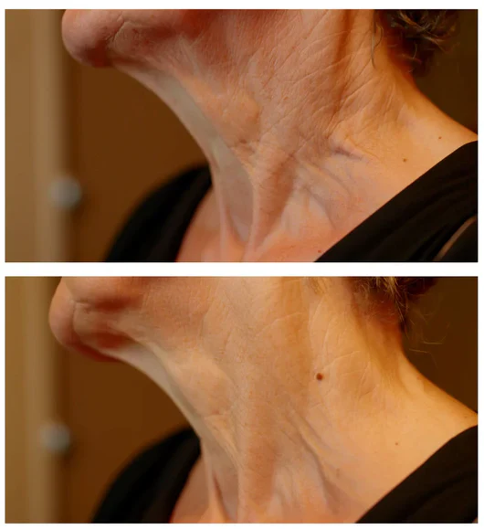 Suero Reafirmante con Péptidos de Cobre y Ácido Hialurónico para Tensar Cuello, Mandíbula y Arrugas - Image 4