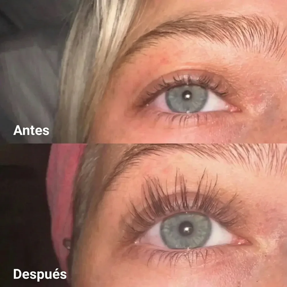 Sérum Crecimiento de Pestañas – Mirada Intensa y Natural - Image 5