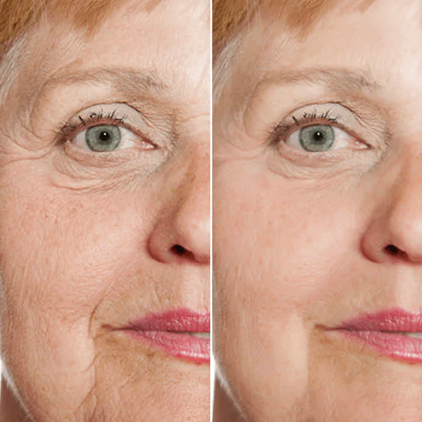Suero Facial Rejuvenecedor - Image 4