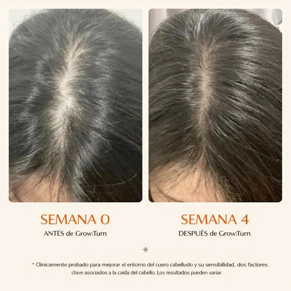 Suero Estimulador de Crecimiento Capilar con Cepillo Masajeador Integrado para Frenar la Caída y Engrosar el Cabello - Image 4